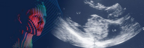 PEDIATRIC ECHO